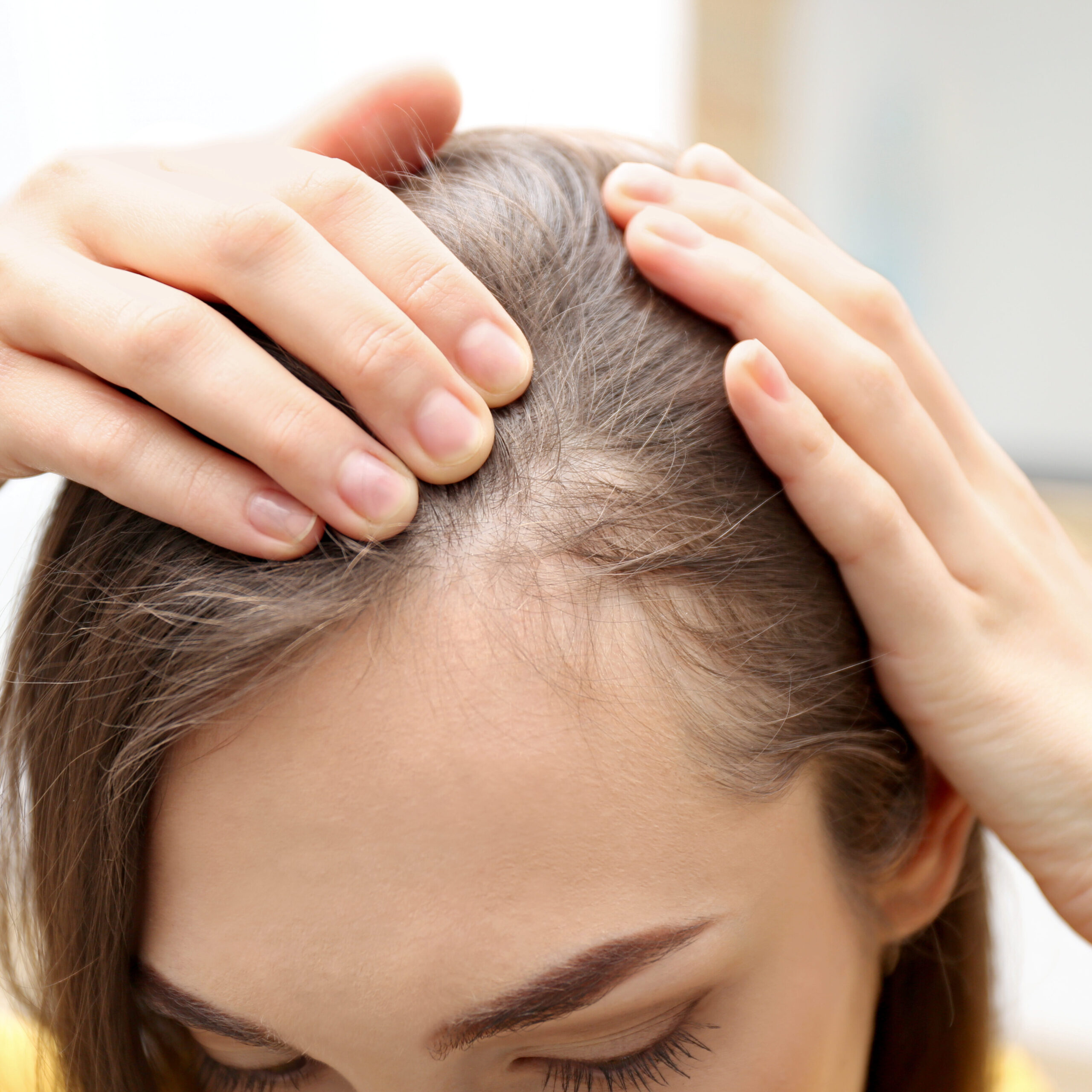 woman hair loss solution los angekes